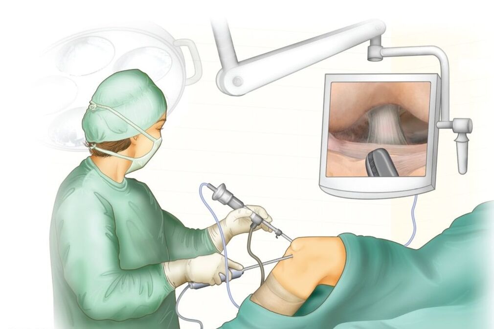 Chirurgie kolenního kloubu