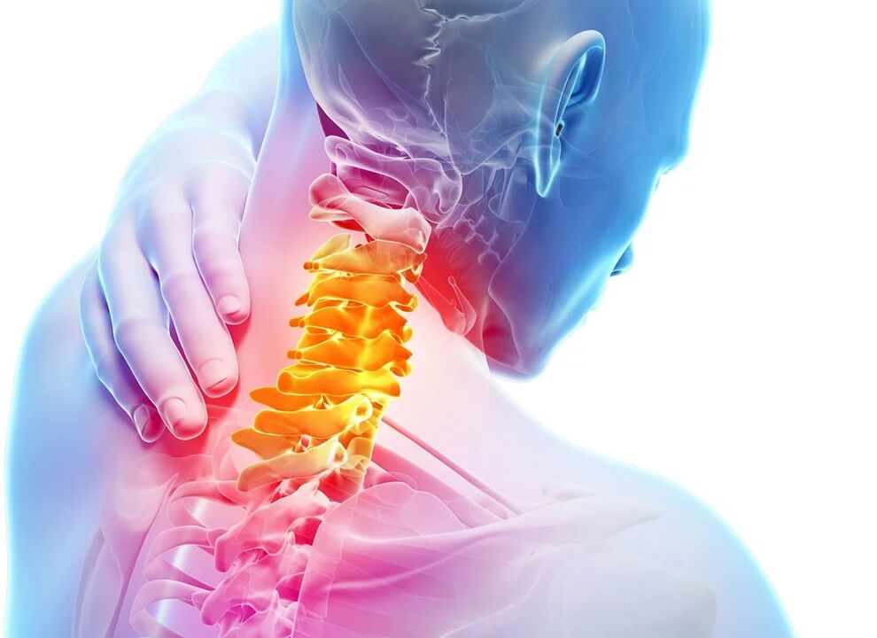 Cervikální osteochondrosis