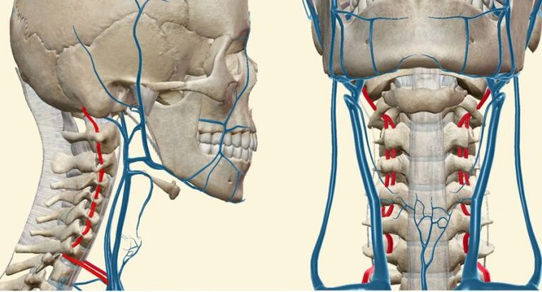 Cévní syndrom při osteochondroze