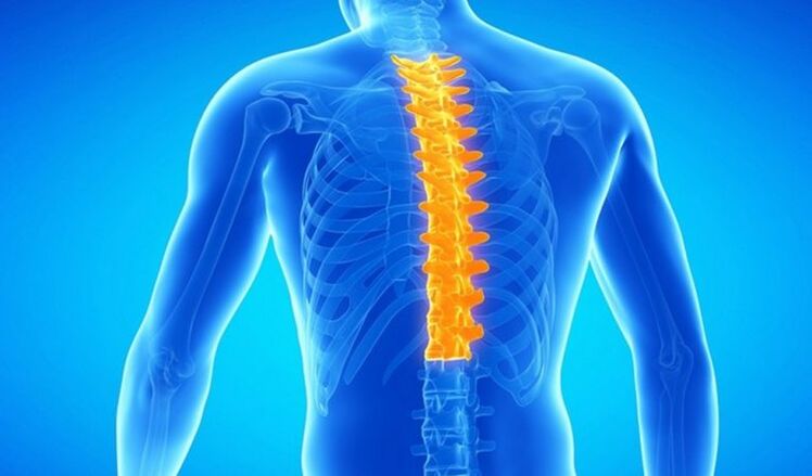 Osteochondroza hrudní páteře